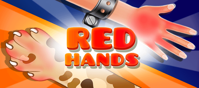 Red Hand Slap Game